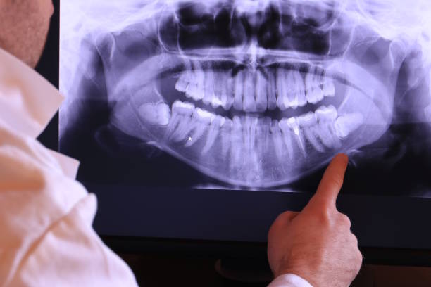 Best Emergency Tooth Extraction in Pennington, NJ