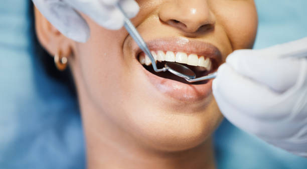 Best Emergency Broken Tooth Repair in Pennington, NJ