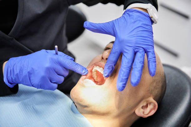 Best Emergency Wisdom Teeth Removal in Pennington, NJ